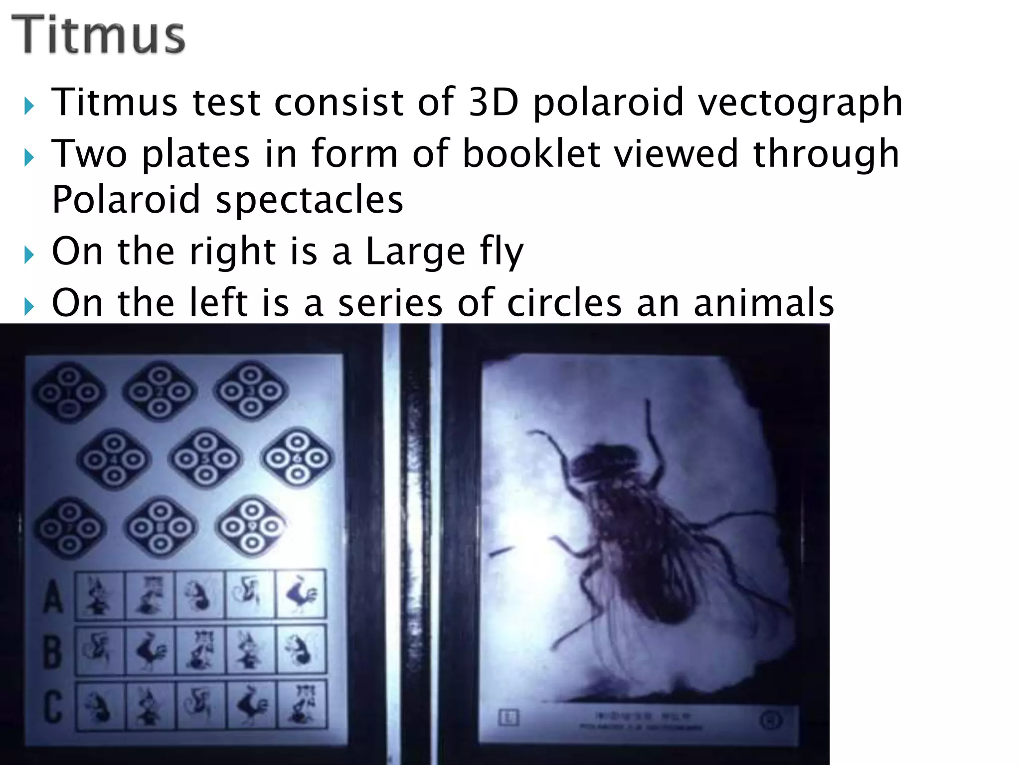  Titmus test consist of 3D polaroid vectograph
 Two plates in form of booklet viewed through
Polaroid spectacles
 On the right is a Large fly
 On the left is a series of circles an animals
 