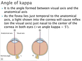  It is the angle formed between visual axis and the
anatomical axis
 As the fovea lies just temporal to the anatomical
axis, a light shown into the cornea will cause reflex
(on the visual axis) just nasal to the center of the
cornea in both eyes (+ve angle kappa = 5°).
 