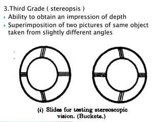 3.Third Grade ( stereopsis )
 Ability to obtain an impression of depth
 Superimposition of two pictures of same object
taken from slightly different angles
 