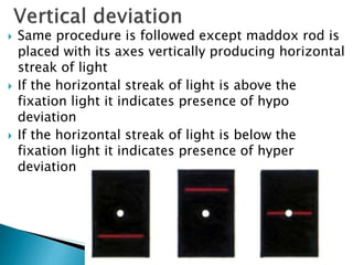  Same procedure is followed except maddox rod is
placed with its axes vertically producing horizontal
streak of light
 If the horizontal streak of light is above the
fixation light it indicates presence of hypo
deviation
 If the horizontal streak of light is below the
fixation light it indicates presence of hyper
deviation
 