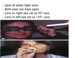  Spot of white light seen
 Both eyes are kept open
 Lens in right eye set at 45o
axis
 Lens in left eye set at 135o axis
 