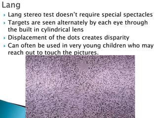  Lang stereo test doesn’t require special spectacles
 Targets are seen alternately by each eye through
the built in cylindrical lens
 Displacement of the dots creates disparity
 Can often be used in very young children who may
reach out to touch the pictures.
 