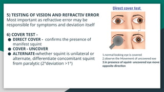 Squint eye case presentation opthalmology | PPTX