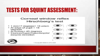 TESTS FOR SQUINT ASSESSMENT:
 