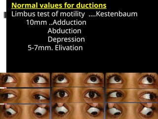Clinical evaluation of strabismus and management of congenital ...