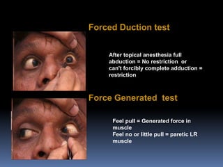 Clinical evaluation of strabismus and management of congenital ...
