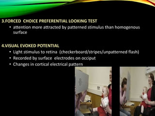 Preferential Test Clinical examination of squint | PPTX
