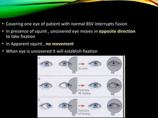 Corrected Squints Clinical examination of squint | PPTX