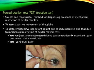 Clinical examination of squint | PPTX