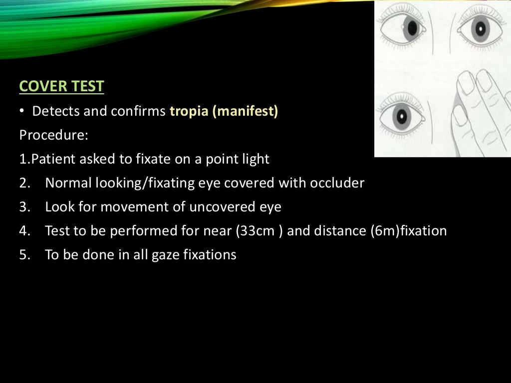 Clinical examination of squint