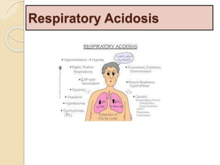 Respiratory Acidosis 
 