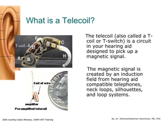 By, Dr. Shamanthakamani Narendran, MD, PhD
What is a Telecoil?
The telecoil (also called a T-
coil or T-switch) is a circu...