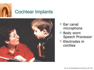 By, Dr. Shamanthakamani Narendran, MD, PhD
Cochlear Implants
 Ear canal
microphone
 Body worn
Speech Processor
 Electro...
