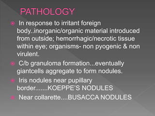 In response to irritant foreign
body..inorganic/organic material introduced
from outside; hemorrhagic/necrotic tissue
within eye; organisms- non pyogenic & non
virulent.
 C/b granuloma formation...eventually
giantcells aggregate to form nodules.
 Iris nodules near pupillary
border.......KOEPPE’S NODULES
 Near collarette....BUSACCA NODULES
 
