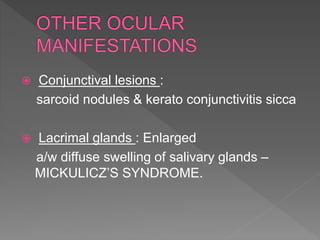  Conjunctival lesions :
sarcoid nodules & kerato conjunctivitis sicca
 Lacrimal glands : Enlarged
a/w diffuse swelling of salivary glands –
MICKULICZ’S SYNDROME.
 