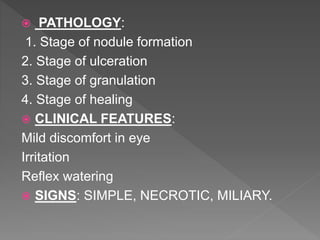  PATHOLOGY:
1. Stage of nodule formation
2. Stage of ulceration
3. Stage of granulation
4. Stage of healing
 CLINICAL FEATURES:
Mild discomfort in eye
Irritation
Reflex watering
 SIGNS: SIMPLE, NECROTIC, MILIARY.
 