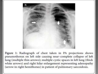 Sravani gembali.pptx[1]