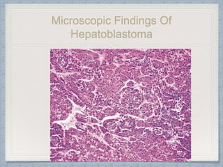 Microscopic Findings Of
Hepatoblastoma
 