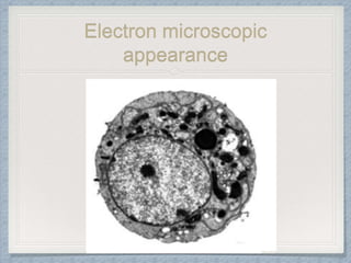Electron microscopic
appearance
 