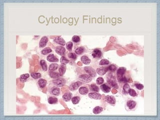 Cytology Findings
 