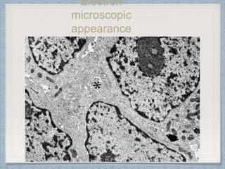 Electron
microscopic
appearance
 