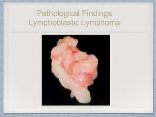 Pathological Findings
Lymphoblastic Lymphoma
 