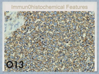 Immun0histochemical Features
 