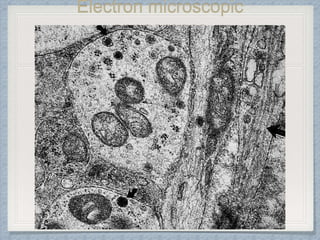 Electron microscopic
appearance
 