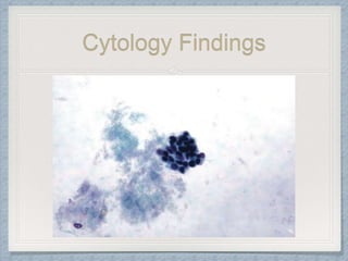 Cytology Findings
 