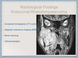 Radiological Findings
Embryonal Rhabdomyosarcoma
Computed tomography (CT) scanning
Magnetic resonance imaging (MRI)
Bone scanning
Ultrasonography
 