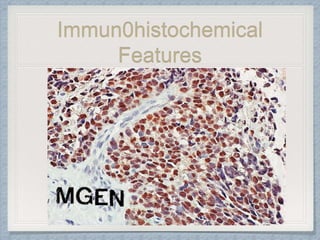 Immun0histochemical
Features
 
