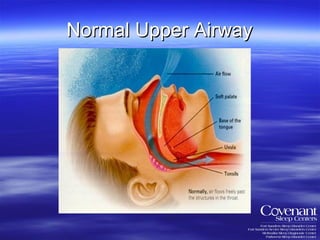 Normal Upper Airway 