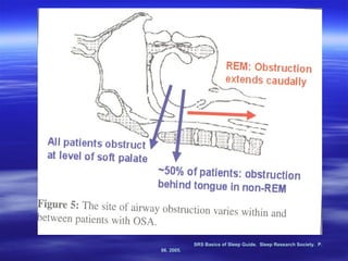 SRS Basics of Sleep Guide.  Sleep Research Society.  P. 96. 2005. 
