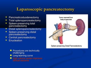 Laparoscopic pancreatectomy
 Pancreaticoduodenectomy
 Total splenopancreatectomy
 Spleen-preserving total





pancreatectomy
Distal splenopancreatectomy
Spleen-preserving distal
pancreatectomy
Central pancreatectomy
Enucleation

 Procedures are technically
challenging
 Long learning curve
 High volume center improves
clinical outcome

 