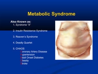 Metabolic Syndrome
Also Known as:
1. Syndrome “X”
2. Insulin Resistance Syndrome
3. Reaven’s Syndrome
4. Deadly Quartet
5. CHAOS
Coronary Artery Disease
Hypertension
Adult Onset Diabetes
Obesity
Stroke

 