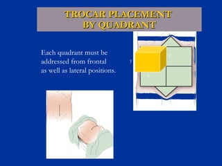 TROCAR PLACEMENT
BY QUADRANT
Each quadrant must be
addressed from frontal
as well as lateral positions.

z

y
x

 