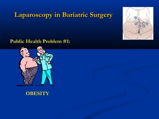 Laparoscopy in Bariatric Surgery

Public Health Problem #1:

OBESITY

 