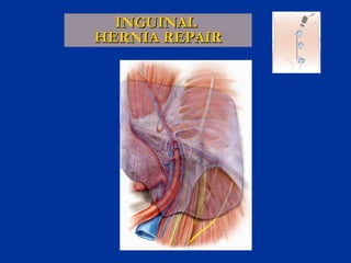 INGUINAL
HERNIA REPAIR

 
