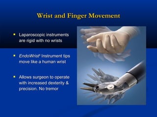 Wrist and Finger Movement
 Laparoscopic instruments
are rigid with no wrists

 EndoWrist® Instrument tips
move like a human wrist

 Allows surgeon to operate
with increased dexterity &
precision. No tremor

 