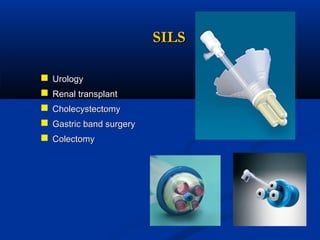 SILS






Urology
Renal transplant
Cholecystectomy
Gastric band surgery
Colectomy

 