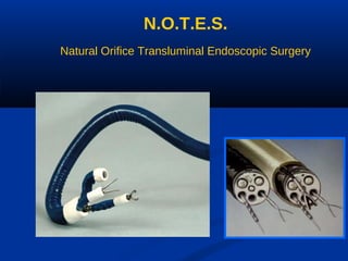N.O.T.E.S.
Natural Orifice Transluminal Endoscopic Surgery

 