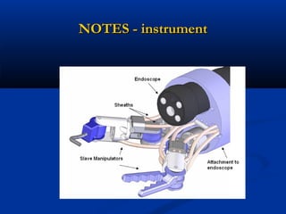 NOTES - instrument

 