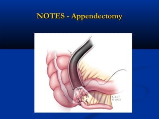 NOTES - Appendectomy

 