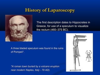 History of Laparoscopy
The first description dates to Hippocrates in
Greece, for use of a speculum to visualize
the rectum (460–375 BC).

A three bladed speculum was found in the ruins
of Pompeii*.

*A roman town buried by a volcano eruption
near modern Naples, Italy - 79 AD).

 