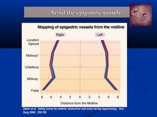 Avoid the epigastric vessels

Saber et al. Safety zones for anterior abdominal wall entry during laparoscopy. Ann
Surg 2004; 239:182

 