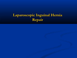 Laparoscopic Inguinal Hernia
Repair

 
