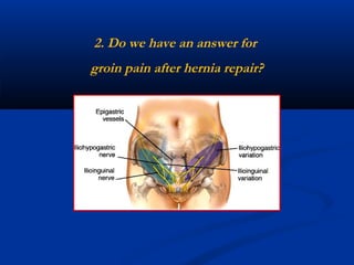 2. Do we have an answer for
groin pain after hernia repair?

 