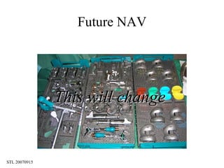 Future NAV This will change 