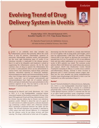 www. dosonline.org l 67
Uvea
www. dosonline.org l 67
Uvea(YROXWLRQ
Pranita Sahay
MBBS
EvolvingTrend of Drug
Delivery System in Uveitis
Pranita Sahay MBBS, Devesh Kumawat MBBS,
Koushik Tripathy MD, DNB, Vijay Kumar Sharma MS
Dr. Rajendra Prasad Centre for Ophthalmic Sciences,
All India Institute of Medical Sciences, New Delhi
Uveitis is an umbrella term that includes any
KPƀCOOCVQT[ RTQEGUU VJCV RTKOCTKN[ CHHGEVU VJG WXGCN
tissue. It may be anterior, intermediate, posterior or
panuveitis. Intermediate, posterior uveitis, and panuveitis
are the most sight threatening types of uveitis. If no
infectious microbe is implicated in the disease process
then it is said to be idiopathic and treatment is aimed at
UWRRTGUUKPI VJG KPƀCOOCVQT[ RTQEGUU $[ HCT VJG OQUV
EQOOQP ENCUU QH FTWI VQ SWGPEJ VJG KPƀCOOCVQT[ ſTG
of uveitis is corticosteroids which can be administered in
various forms- oral, intravenous, topical drops, periocular
injection, intravitreal injection or intraocular implants.
Immunosuppressive agents and immunomodulators are the
other class of drugs used in the management of idiopathic
uveitis. Long term use of systemic corticosteroids and
immunomodulators have high risk of systemic adverse
effects and topical medication have poor penetration to the
posterior segment of eye. This has lead to a new era of
invention of sustained drug delivery system1
.
Retisert®
Introduced by Bausch and Lomb (Rochester, NY, USA)
in 1951, it is a non biodegradable, sustained release
KPVTCXKVTGCN KORNCPV QH ƀWEKPQNQPG CEGVQPKFG  OI +V JCU
been FDA-approved (Food and Drug Administration, USA)
for chronic macular edema due to chronic non infectious
posterior uveitis2
. Retisert is about the size of a grain of
rice and consists of a tablet encased in a silicone elastomer
EWR EQPVCKPKPI C TGNGCUG QTKſEG CPF C 2QN[XKP[N CNEQJQN
(PVA) membrane positioned between the tablet and the
QTKſEG 6JG UKNKEQPG GNCUVQOGT EWR CUUGODN[ KU CVVCEJGF VQ
a PVA suture strut with silicone adhesive. It is implanted
into the vitreous cavity by par plana incision and then
suturing. The drug is delivered at initial rate of 0.6 μg/day,
FGETGCUKPI QXGT VJG ſTUV OQPVJ VQ C UVGCF[ UVCVG DGVYGGP
0.3 to 0.4 μg/day with no drug peaks and troughs, and it
lasts for approximately 1,000 days (30 months). During
clinical trials it has shown to decrease the recurrence of
episode from 54 % to 7% and 40% to 14% in two different
trials and also either stabilisation or an increase in visual
acuity in 80% patients was noted. The common ocular
adverse effects with Retisert are raised intraocular pressure
and cataract. MUST trial (Multicenter Uveitis Steroid
6TGCVOGPV GXCNWCVKPI KVU GHſECE[ KP WXGKVKU XGTUWU U[UVGOKE
CPVKKPƀCOOCVQT[ VJGTCR[ UJQYGF  VKOGU KPETGCUG KP
glaucoma and 3.3 times increased cataract surgery rate3
.
Rare but the most dreaded one being endophthalmitis.
Another major disadvantage with Retisert is that it can’t be
KORNCPVGF KP CP QHſEG RTQEGFWTG 
(KIWTG 
Iluvien®
Iluvien® (formerlyMedidurFA,AlimeraSciences,Alpharetta,
GA, USA) is a non biodegradable intravitreal implant of
ƀWEKPQNQPG CEGVQPKFG  zI +V EQPUKUVU QH C E[NKPFTKECN
polyimide tube, 3.5mm in length and 0.37mm in diameter.
Unlike Retisert however, Iluvien® is injected into the eye
CU CP QHſEG DCUGF RTQEGFWTG WUKPI C RTQRTKGVCT[ KPUGTVGT
with a 25-gauge needle, which allows a self sealing wound.
Figure 1: Retisert
 