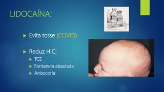 LIDOCAÍNA:
 Evita tosse (COVID)
 Reduz HIC:
 TCE
 Fontanela abaulada
 Anisocoria
 